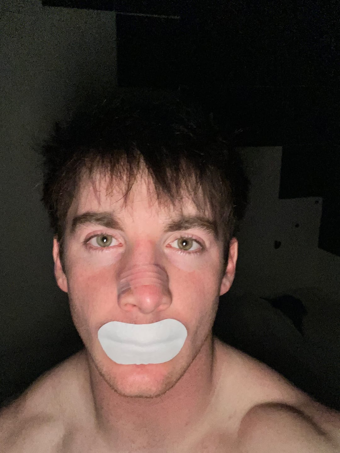 Real customer photo wearing a clear nasal strip across the nose bridge with mouth tape on the lips.